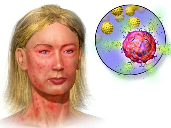 ehinokoki in simptomi njihove prisotnosti v telesu